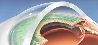 Eye care tips for computer users